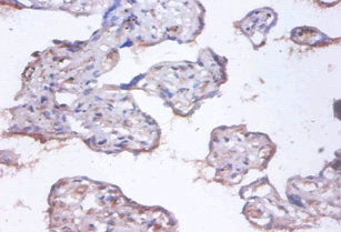 Immunohistochemistry of paraffin-embedded human placenta tissue using CSB-PA04965A0Rb at dilution of 1:100