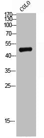 Western Blot analysis of COLO cells using CD75 Polyclonal Antibody