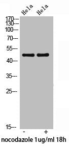 Western Blot analysis of HeLa nocodazole 1ug/ml 18h cells using Phospho-p47-phox (S359) Polyclonal Antibody