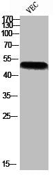 Western blot analysis of VEC using p-p47-phox (S370) antibody.