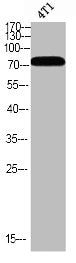 Western blot analysis of 4T1 using p-Bmx (Y566) antibody.