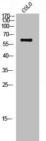 Western Blot analysis of COLO cells using Phospho-c-Src (S75) Polyclonal Antibody
