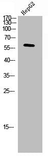 Western Blot analysis of HepG2 cells using c-Src Polyclonal Antibody