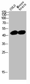 Western Blot analysis of MOUSE-BRAIN COLO cells using SRF Polyclonal Antibody