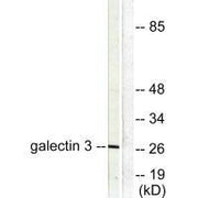 Western blot analysis of extracts from HeLa cells, using Galectin 3 antibody.