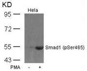 Western blot analysis of extracts from Hela cells untreated or treated with PMA using Smad1(Phospho-Ser465) Antibody.