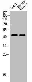 Western Blot analysis of MOUSE-BRAIN COLO cells using NK-1R Polyclonal Antibody