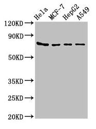 Western Blot Positive WB detected in: Hela whole cell lysate, MCF-7 whole cell lysate, HepG2 whole cell lysate, A549 whole cell lysate All lanes: HSPA5 antibody at 4µg/ml Secondary Goat polyclonal to rabbit IgG at 1/50000 dilution Predicted band s...