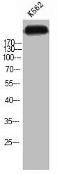 Western Blot analysis of K562 cells using Tensin-1 Polyclonal Antibody