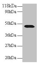 Western blot All lanes: CNPY2 antibody at 2µg/ml + 293T whole cell lysate Secondary Goat polyclonal to rabbit IgG at 1/15000 dilution Predicted band size: 21, 10 kDa Observed band size: 47 kDa