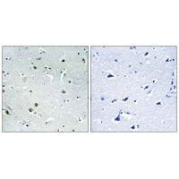 Immunohistochemistry analysis of paraffin-embedded human brain tissue using DDX24 antibody.