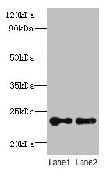 Western blot All lanes: TMED2 antibody at 6µg/ml Lane 1: HCT116 whole cell lysate Lane 2: Mouse ovarian tissue Secondary Goat polyclonal to rabbit IgG at 1/10000 dilution Predicted band size: 23 kDa Observed band size: 23 kDa