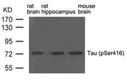 Western blot analysis of extract from rat brain, rat hippocampus and mouse brain using Tau(phospho-Ser416) Antibody.