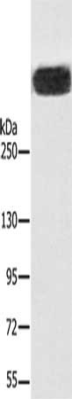 Gel: 6%SDS-PAGE, Lysate: 40 ug, Lane: Mouse brain tissue, Primary antibody: CSB-PA050519(RYR1 Antibody) at dilution 1/400, Secondary antibody: Goat anti rabbit IgG at 1/8000 dilution, Exposure time: 2 minutes