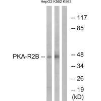 Western blot analysis of extracts from HepG2 cells and K562 cells, using PKA-R2β (Ab-113) antibody.