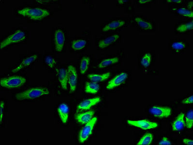 Immunofluorescent analysis of Hela cells using CSB-PA05074A0Rb at dilution of 1:100 and Alexa Fluor 488-congugated AffiniPure Goat Anti-Rabbit IgG(H+L)