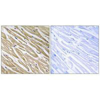 Immunohistochemistry analysis of paraffin-embedded human heart tissue using C5orf13 antibody.