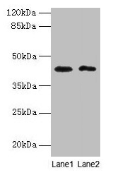 Western blot All lanes: BTBD2 antibody at 6µg/ml Lane 1: Hela whole cell lysate Lane 2: MDA-MB-231 whole cell lysate Secondary Goat polyclonal to rabbit IgG at 1/10000 dilution Predicted band size: 56, 23 kDa Observed band size: 42 kDa