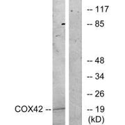 Western blot analysis of extracts from K562 cells, treated with insulin (0.01U/ml, 15mins), using COX42 antibody.