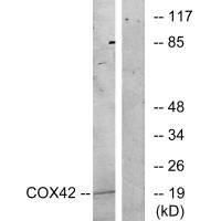 Western blot analysis of extracts from K562 cells, treated with insulin (0.01U/ml, 15mins), using COX42 antibody.