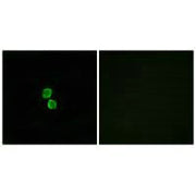 Immunofluorescence analysis of MCF-7 cells, using CKLF1 antibody.