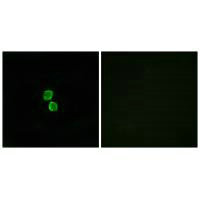 Immunofluorescence analysis of MCF-7 cells, using CKLF1 antibody.