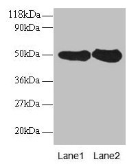Western blot All lanes: RPN1 antibody at 2µg/ml Lane 1: EC109 whole cell lysate Lane 2: 293T whole cell lysate Secondary Goat polyclonal to rabbit IgG at 1/15000 dilution Predicted band size: 50 kDa Observed band size: 50 kDa