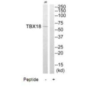 Western blot analysis of extracts from Jurkat cells, using TBX18 antibody.