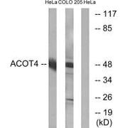Western blot analysis of extracts from HeLa cells and COLO cells, using ACOT4 antibody.