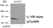 Western blot analysis of extracts HUVEC tissue using IL-10R alpha (Phospho-Tyr496) antibody.The lane on the right is treated with the antigen-specific peptide.