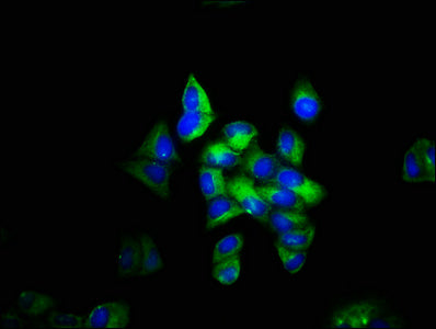 Immunofluorescence staining of Hela cells with CSB-PA05189A0Rb at 1:133, counter-stained with DAPI. The cells were fixed in 4% formaldehyde, permeabilized using 0.2% Triton X-100 and blocked in 10% normal Goat Serum. The cells were then incubated...