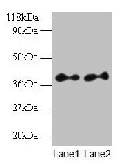 Western blot All lanes: SCAMP3 antibody at 2µg/ml Lane 1: EC109 whole cell lysate Lane 2: 293T whole cell lysate Secondary Goat polyclonal to rabbit IgG at 1/15000 dilution Predicted band size: 39, 36 kDa Observed band size: 39 kDa