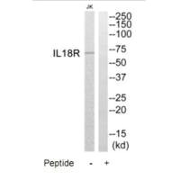 Western blot analysis of extracts from Jurkat cells, using IL18R antibody.