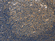 The image on the left is immunohistochemistry of paraffin-embedded Human tonsil tissue using CSB-PA052047(DUSP26 Antibody) at dilution 1/50, on the right is treated with fusion protein. (Original magnification: ×200)