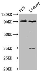 Western Blot Positive WB detected in: PC-3 whole cell lysate, Rat kidney tissue All lanes: CDK11A antibody at 4µg/ml Secondary Goat polyclonal to rabbit IgG at 1/50000 dilution Predicted band size: 92, 91, 46, 19, 63, 50 kDa Observed band size: 92...
