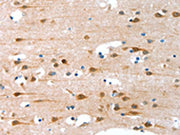 The image on the left is immunohistochemistry of paraffin-embedded Human brain tissue using CSB-PA052274(ALS2CR11 Antibody) at dilution 1/30, on the right is treated with fusion protein. (Original magnification: ×200)