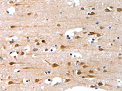 The image on the left is immunohistochemistry of paraffin-embedded Human brain tissue using CSB-PA052274(ALS2CR11 Antibody) at dilution 1/30, on the right is treated with fusion protein. (Original magnification: ×200)