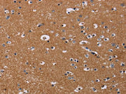 The image on the left is immunohistochemistry of paraffin-embedded Human brain tissue using CSB-PA052500(NRAS Antibody) at dilution 1/30, on the right is treated with synthetic peptide. (Original magnification: ×200)