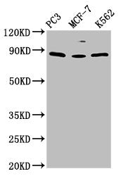 Western Blot Positive WB detected in: PC-3 whole cell lysate, MCF-7 whole cell lysate, K562 whole cell lysate All lanes: TRIM28 antibody at 1.5ug/ml Secondary Goat polyclonal to rabbit IgG at 1/50000 dilution Predicted band size: 89, 80 kDa Observ...