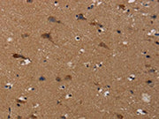 The image on the left is immunohistochemistry of paraffin-embedded Human brain tissue using CSB-PA052632(TP53INP1 Antibody) at dilution 1/50, on the right is treated with synthetic peptide. (Original magnification: ×200)