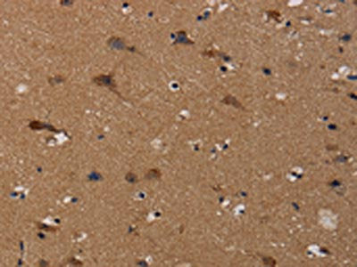 The image on the left is immunohistochemistry of paraffin-embedded Human brain tissue using CSB-PA052632(TP53INP1 Antibody) at dilution 1/50, on the right is treated with synthetic peptide. (Original magnification: ×200)