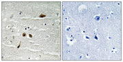 Immunohistochemical analysis of paraffin-embedded human brain tissue using MDC1 (Phospho-Ser513) antibody (left)or the same antibody preincubated with blocking peptide (right).