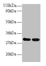 Western blot All lanes: ARHGEF18 antibody at 2µg/ml Lane 1: EC109 whole cell lysate Lane 2: 293T whole cell lysate Secondary Goat polyclonal to rabbit IgG at 1/15000 dilution Predicted band size: 131, 115 kDa Observed band size: 30 kDa