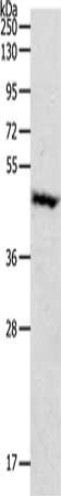 Gel: 10%SDS-PAGE, Lysate: 60 ug, Lane: Mouse pancreas tissue, Primary antibody: CSB-PA052803(PDK4 Antibody) at dilution 1/900, Secondary antibody: Goat anti rabbit IgG at 1/8000 dilution, Exposure time: 10 minutes