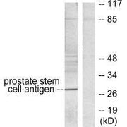 Western blot analysis of extracts from mouse prostate, using Prostate Stem Cell Antigen antibody.