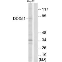 Western blot analysis of extracts from HepG2 cells, using DDX51 antibody.