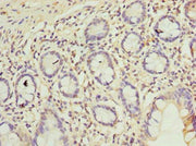 Immunohistochemistry of paraffin-embedded human small intestine tissue using CSB-PA05339A0Rb at dilution of 1:100