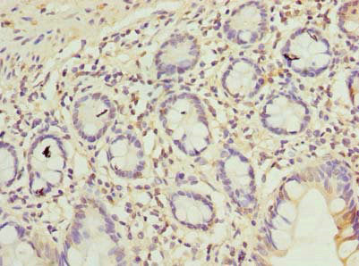 Immunohistochemistry of paraffin-embedded human small intestine tissue using CSB-PA05339A0Rb at dilution of 1:100