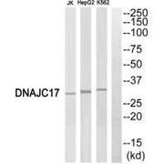 Western blot analysis of extracts from Jurkat cells, HepG2 cells and K562 cells, using DNAJC17 antibody.