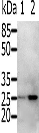 Gel: 10%SDS-PAGE, Lysate: 30 ug, Lane 1-2: 231 cells, Human fetal brain tissue, Primary antibody: CSB-PA053446(RAB5A Antibody) at dilution 1/600, Secondary antibody: Goat anti rabbit IgG at 1/8000 dilution, Exposure time: 1 minute